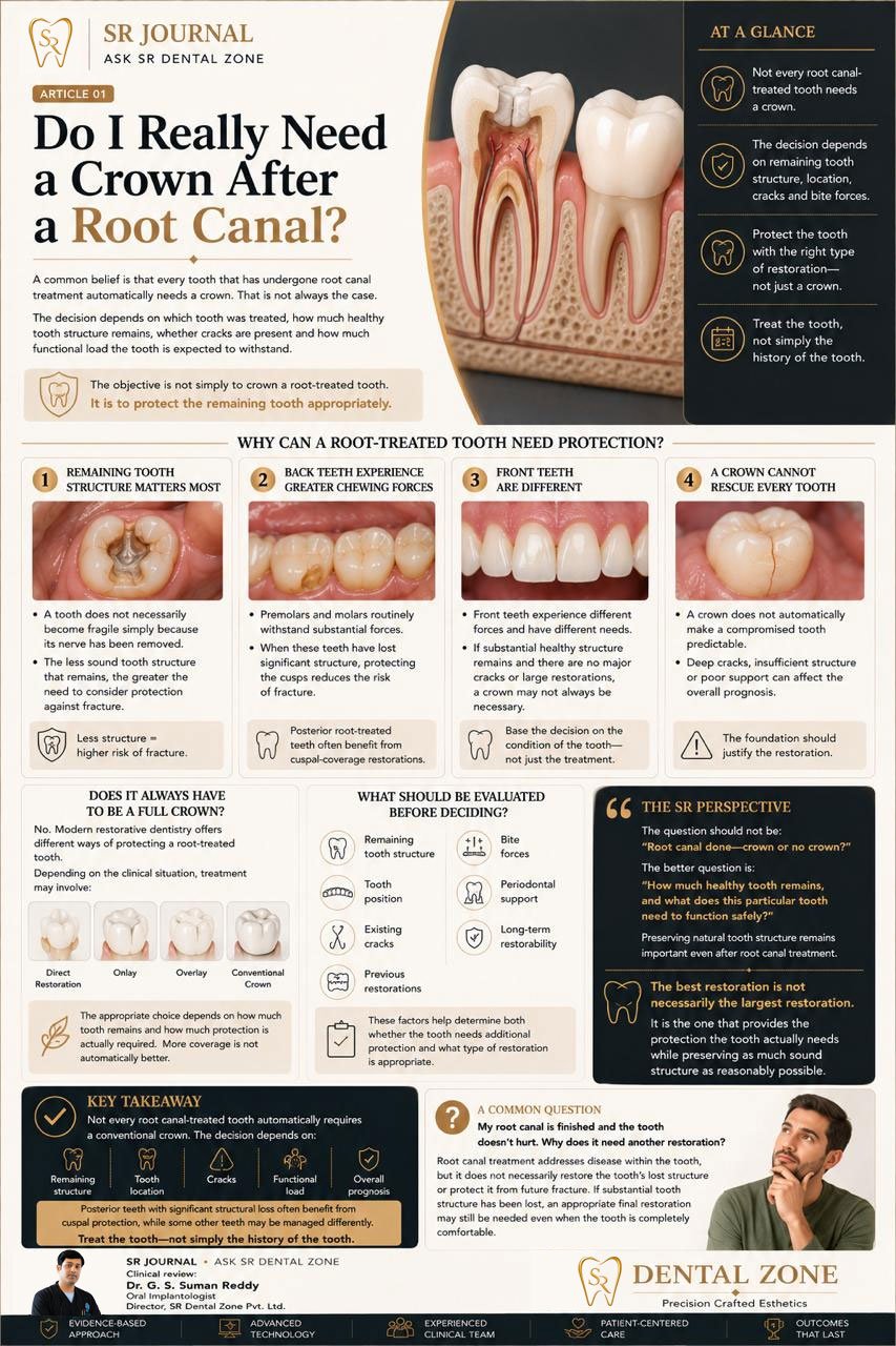 Do I Really Need a Crown After a Root Canal?