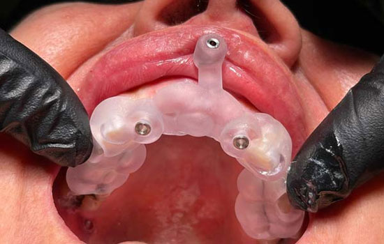 Best dental clinic in Bangalore