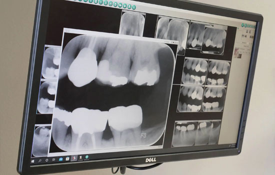 Kids dentist Bangalore