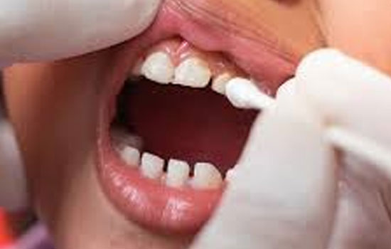 Kids dentist Bangalore
