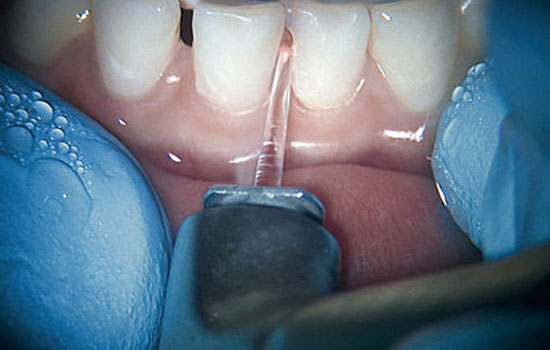 Kids dentist Bangalore