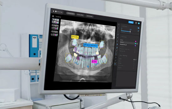 Teeth cleaning Bangalore