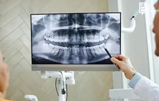 Teeth cleaning Bangalore