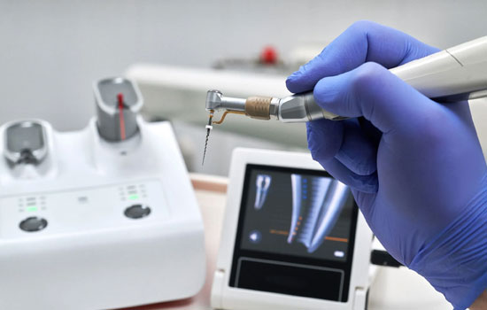 Root canal treatment Bangalore