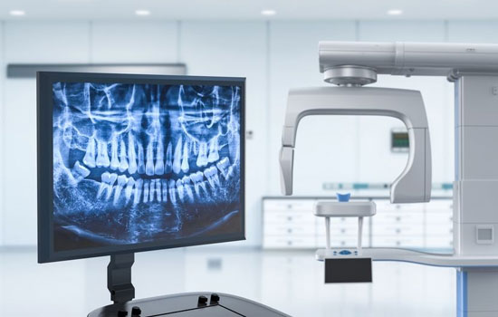 Root canal treatment Bangalore