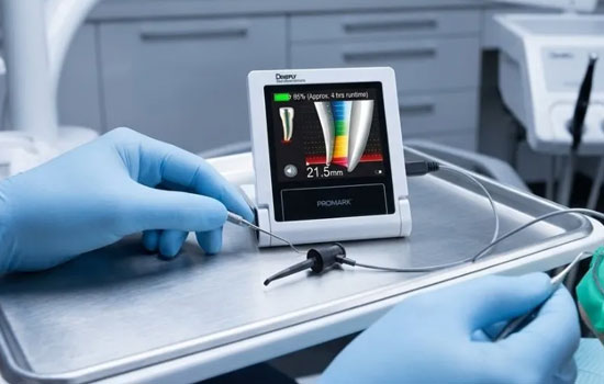 Root canal treatment Bangalore