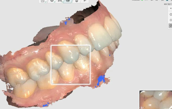 Digital Orthodontics Bangalore