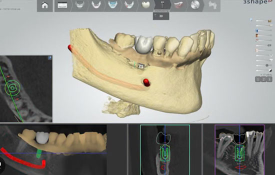 Best dental clinic in Bangalore