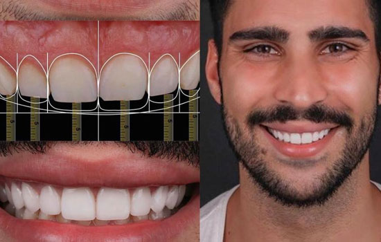 Digital Orthodontics Bangalore