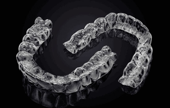 Digital Orthodontics Bangalore