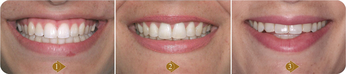 Dental specialist in Bangalore