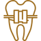 Digital orthodontics Bangalore