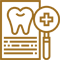 Single tooth implant Bangalore
