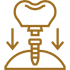 Dental implants Bangalore 