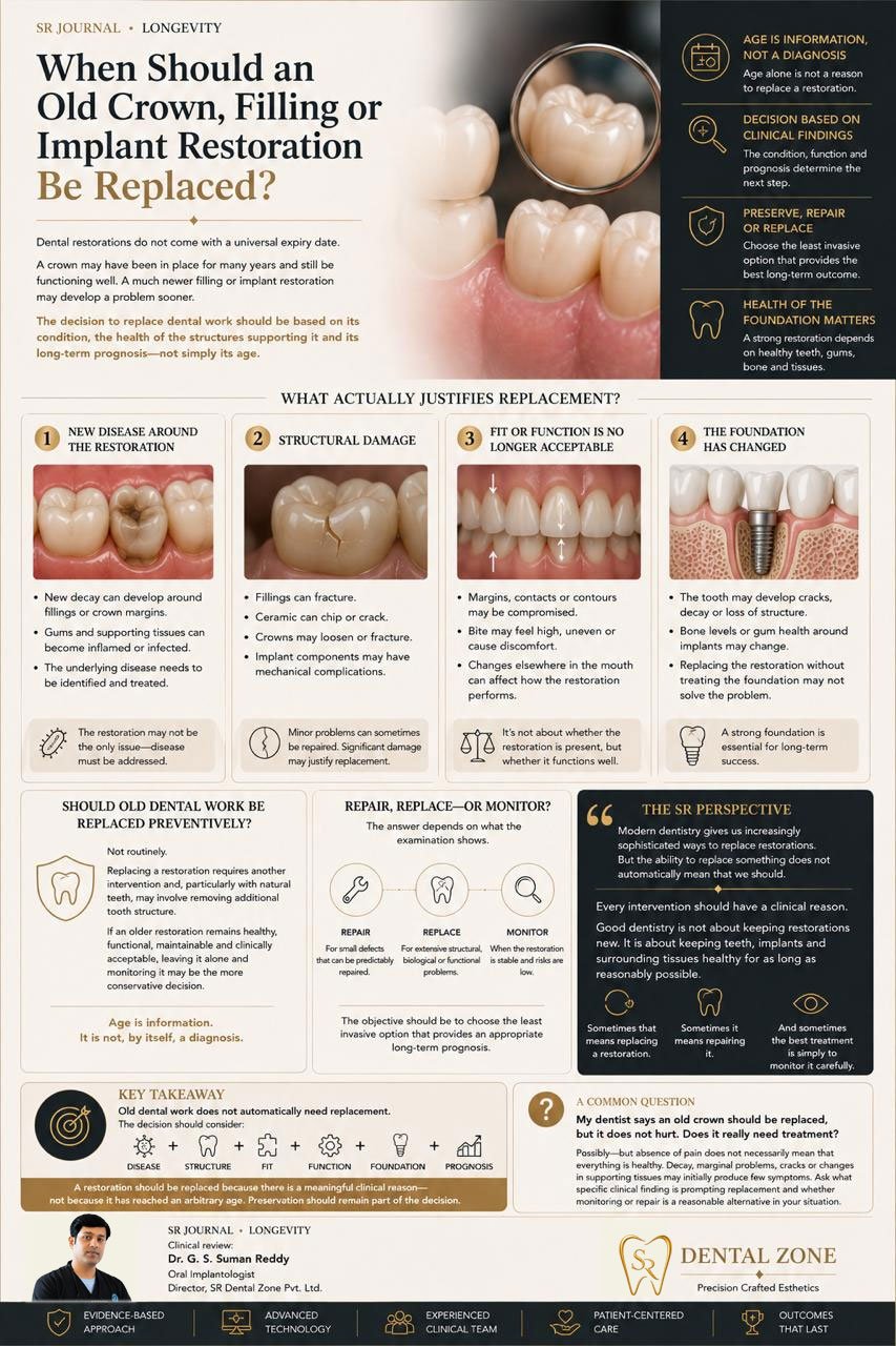 When Should an Old Crown, Filling or Implant Restoration Be Replaced?